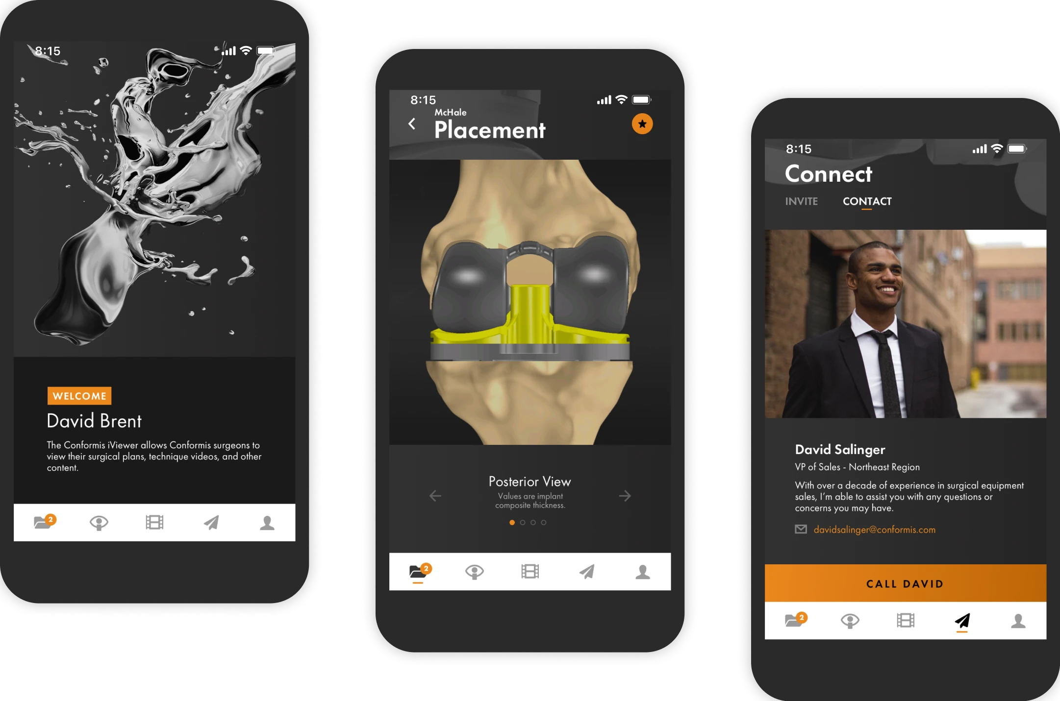 Three phones showing the Conformis iViewer app: a welcome screen, a knee implant Placement view, and a Connect screen with a sales rep's contact card